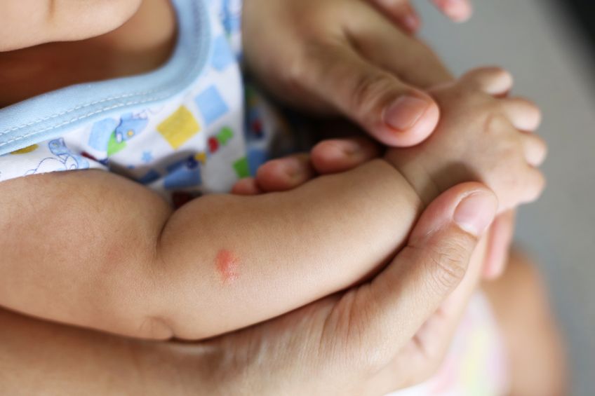 10 remèdes maison pour soulager les piqûres de moustiques