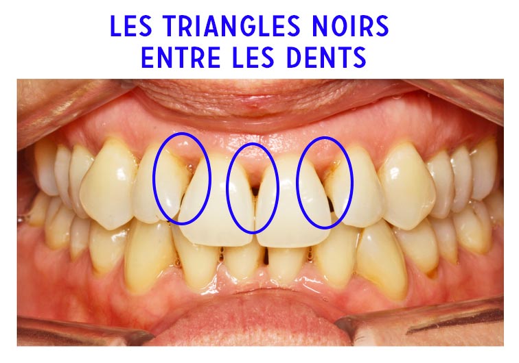 Orthodontiste à Paris : appareil lingual, Invisalign et bagues - Adultes et enfants