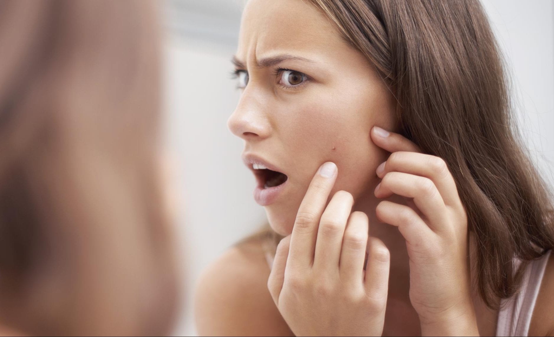 5 conseils pour se débarrasser des taches faciales post-acné