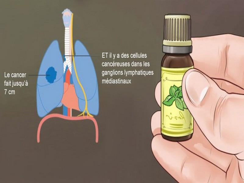 La vérité sur le cancer et les huiles essentielles: ce qu’aucun oncologue ne vous dira