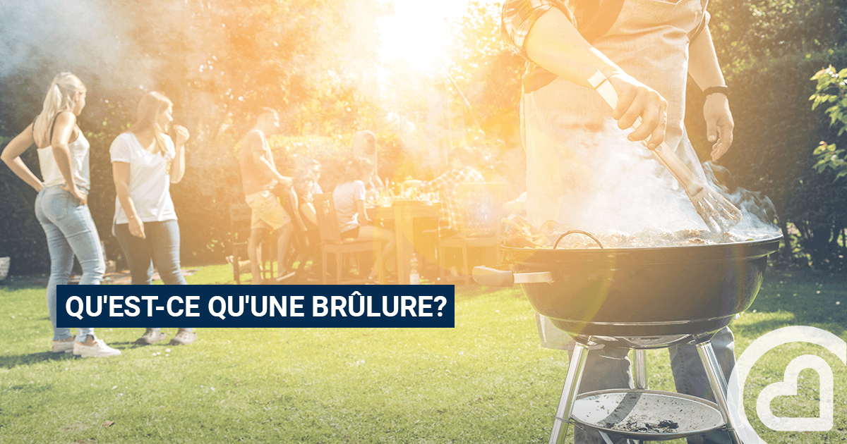 Que sont les brûlures ? – Famipril